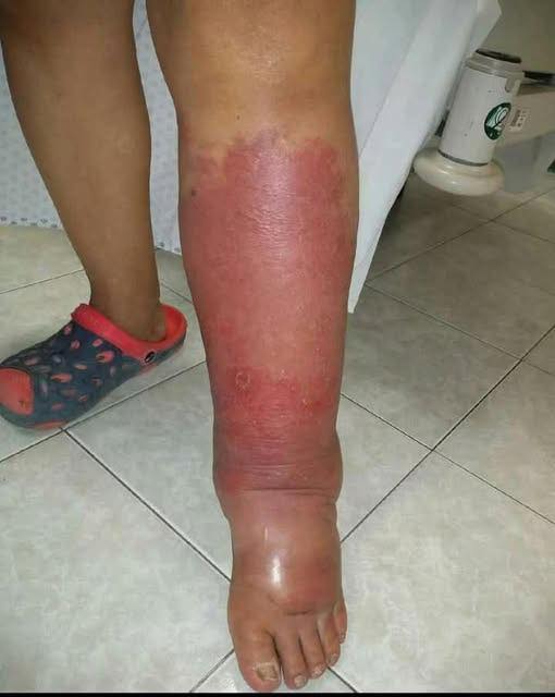 Signs on your FEET that indicate he is cr… see more